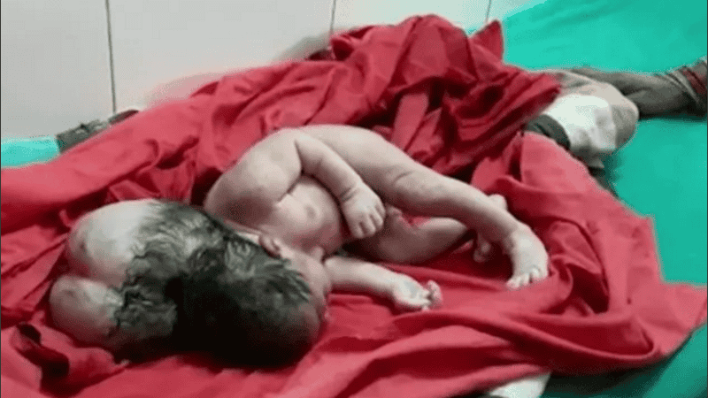 La beba nacida en la India. 
