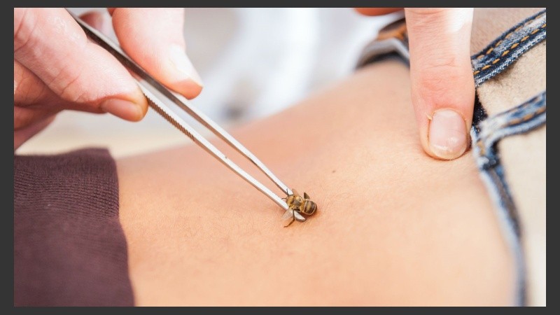 Muchos expertos sostienen que en realidad esta técnica es la base de la acupuntura.