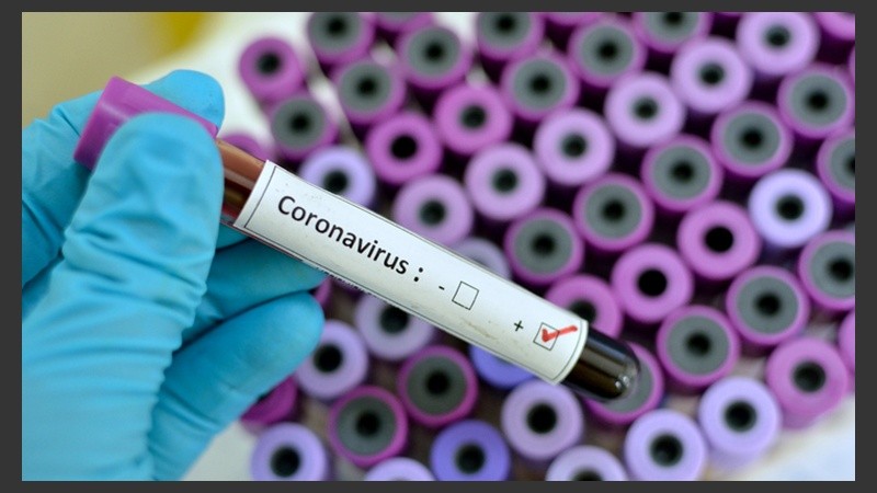 Test de coronavirus positivo.