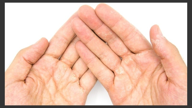 Cómo ayudar a que la piel de las manos se mejore con sencillos tips