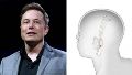 Elon Musk aseguró que su empresa de chips cerebrales podría comenzar las pruebas en humamos en pocos meses