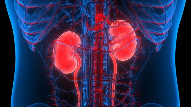 Más del 10 por ciento de la población sufre de enfermedad renal crónica.